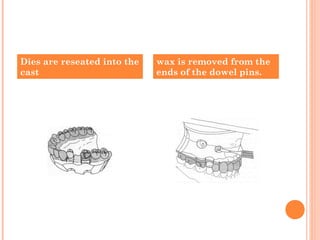 Dies are reseated into the
cast
wax is removed from the
ends of the dowel pins.
 