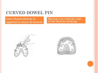 coat of petrolatum is
applied to stone & dowels
Boxing wax with the tips
of the dowels sticking
CURVED DOWEL PIN
 