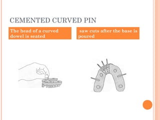 CEMENTED CURVED PIN
The head of a curved
dowel is seated
saw cuts after the base is
poured
 