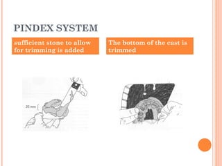 PINDEX SYSTEM
sufficient stone to allow
for trimming is added
The bottom of the cast is
trimmed
 