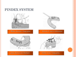 PINDEX SYSTEM
 White sleeves > long pinsWhite sleeves > long pins  bottom of cast is lubricatedbottom of cast is lubricated
 Utility wax > long pins.Utility wax > long pins. gray sleeves are blockedgray sleeves are blocked
 