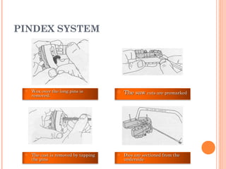 PINDEX SYSTEM
 Wax over the long pins isWax over the long pins is
removed.removed.
 The sawThe saw cuts are premarkedcuts are premarked
 Dies are sectioned from theDies are sectioned from the
undersideunderside
 The cast is removed by tappingThe cast is removed by tapping
the pinsthe pins
 