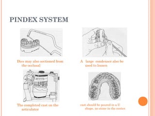 PINDEX SYSTEM
Dies may also sectioned from
the occlusal
A large condenser also be
used to loosen
cast should be poured in a U
shape, no stone in the center.
The completed cast on the
articulator
 