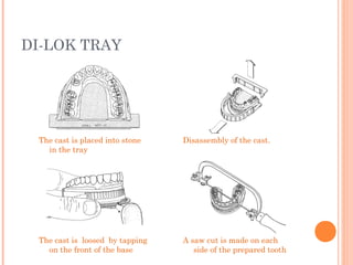 DI-LOK TRAY
The cast is placed into stone
in the tray
Disassembly of the cast.
A saw cut is made on each
side of the prepared tooth
The cast is loosed by tapping
on the front of the base
 