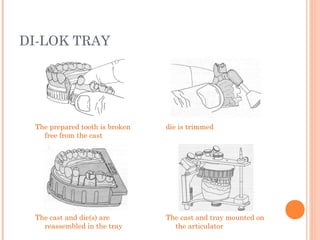 DI-LOK TRAY
The prepared tooth is broken
free from the cast
die is trimmed
The cast and tray mounted on
the articulator
The cast and die(s) are
reassembled in the tray
 
