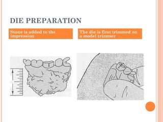 DIE PREPARATION
Stone is added to the
impression
The die is first trimmed on
a model trimmer
 