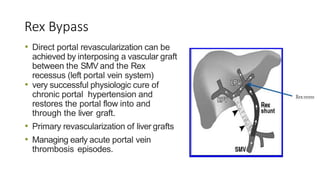 Rex Bypass
• Direct portal revascularization can be
achieved by interposing a vascular graft
between the SMV and the Rex
recessus (left portal vein system)
• very successful physiologic cure of
chronic portal hypertension and
restores the portal flow into and
through the liver graft.
• Primary revascularization of liver grafts
• Managing early acute portal vein
thrombosis episodes.
 