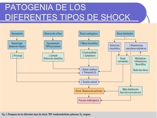 PATOGENIA DE LOS DIFERENTES TIPOS DE SHOCK 