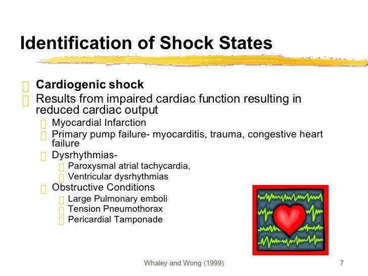 Identification of Shock