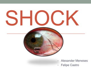 SHOCK
• Alexander Meneses

• Felipe Castro

 