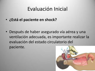 Evaluación Inicial
• ¿Está el paciente en shock?
• Después de haber asegurado vía aérea y una
ventilación adecuada, es importante realizar la
evaluación del estado circulatorio del
paciente.

 