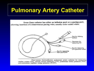Pulmonary Artery Catheter

 