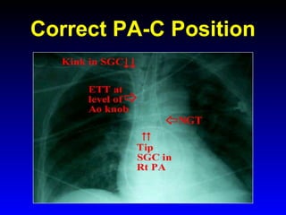Correct PA-C Position

 