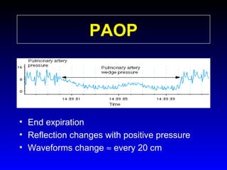 PAOP

• End expiration
• Reflection changes with positive pressure
• Waveforms change ≈ every 20 cm

 