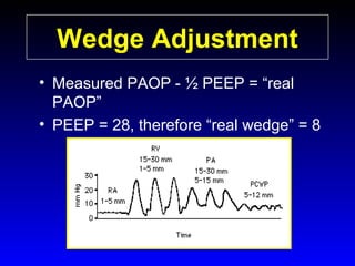 Wedge Adjustment
• Measured PAOP - ½ PEEP = “real
PAOP”
• PEEP = 28, therefore “real wedge” = 8

 