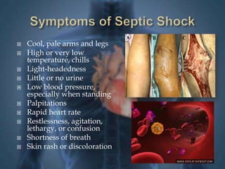  Cool, pale arms and legs 
 High or very low 
temperature, chills 
 Light-headedness 
 Little or no urine 
 Low blood pressure, 
especially when standing 
 Palpitations 
 Rapid heart rate 
 Restlessness, agitation, 
lethargy, or confusion 
 Shortness of breath 
 Skin rash or discoloration 
 