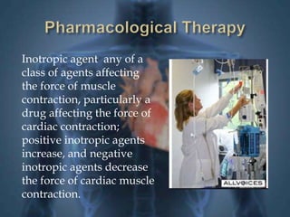 Inotropic agent any of a 
class of agents affecting 
the force of muscle 
contraction, particularly a 
drug affecting the force of 
cardiac contraction; 
positive inotropic agents 
increase, and negative 
inotropic agents decrease 
the force of cardiac muscle 
contraction. 
 