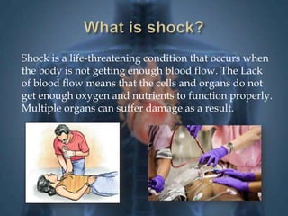 Shock is a life-threatening condition that occurs when 
the body is not getting enough blood flow. The Lack 
of blood flow means that the cells and organs do not 
get enough oxygen and nutrients to function properly. 
Multiple organs can suffer damage as a result. 
 