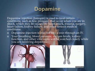 Dopamine injection (Intropin) is used to treat certain 
conditions, such as low pressure, that occur when you are in 
shock, which may be caused by heart attack, trauma, surgery, 
heart failure, kidney failure, and other serious medical 
conditions. 
 Dopamine injection is injected into a vein through an IV. 
 Your breathing, blood pressure, oxygen levels, kidney 
function, and other vital signs will be watched closely while 
you are receiving dopamine. 
 