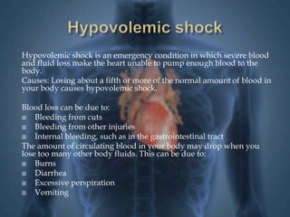 Hypovolemic shock is an emergency condition in which severe blood 
and fluid loss make the heart unable to pump enough blood to the 
body. 
Causes: Losing about a fifth or more of the normal amount of blood in 
your body causes hypovolemic shock. 
Blood loss can be due to: 
 Bleeding from cuts 
 Bleeding from other injuries 
 Internal bleeding, such as in the gastrointestinal tract 
The amount of circulating blood in your body may drop when you 
lose too many other body fluids. This can be due to: 
 Burns 
 Diarrhea 
 Excessive perspiration 
 Vomiting 
 