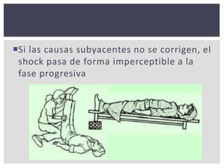 Si las causas subyacentes no se corrigen, el
shock pasa de forma imperceptible a la
fase progresiva
 