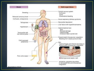 Shock - management | PPTX