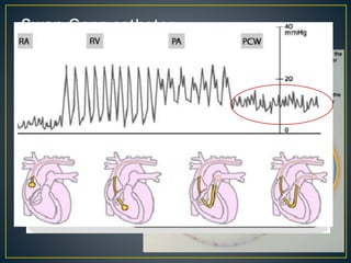 Shock - management | PPTX