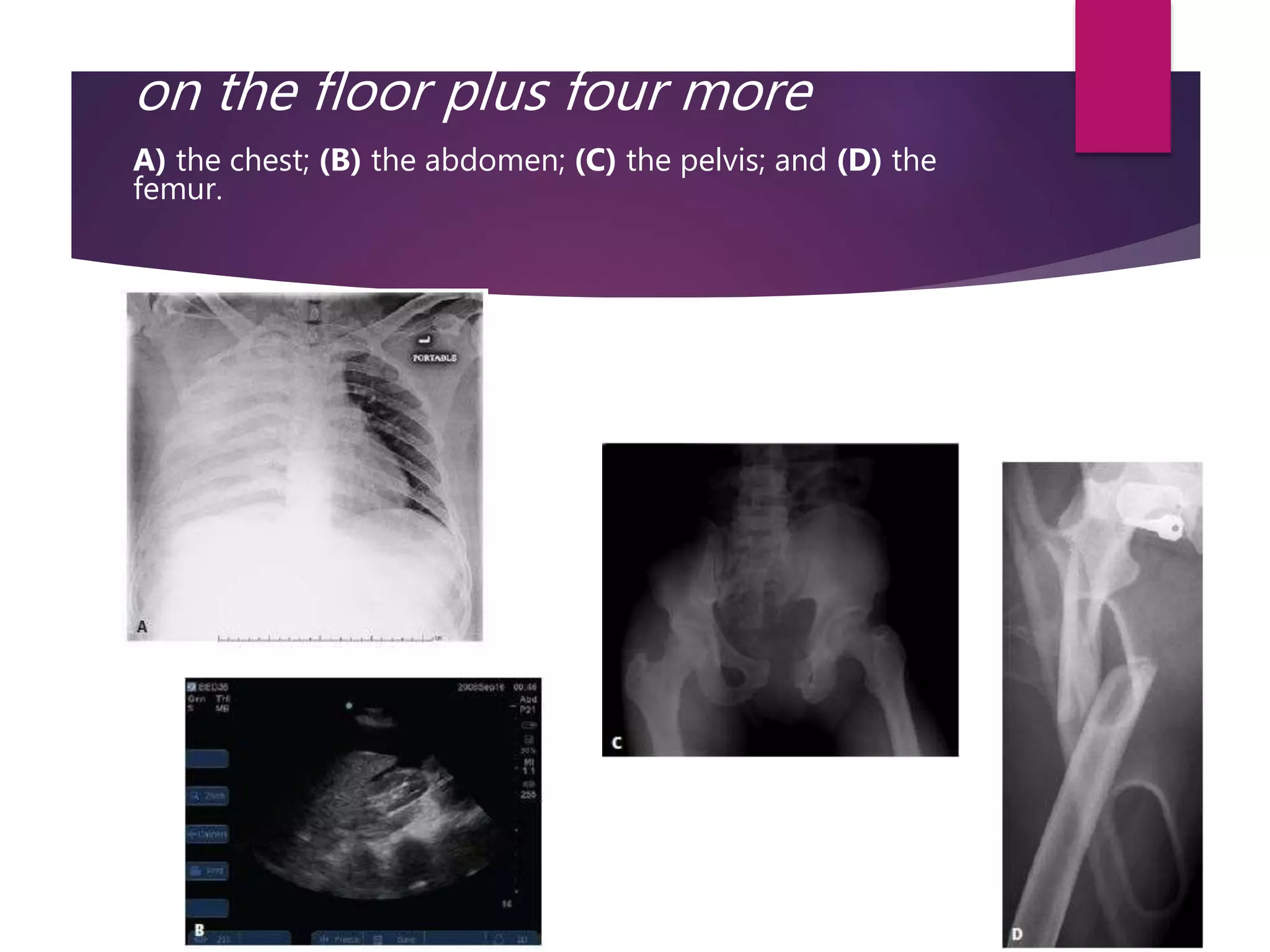 on the floor plus four more
A) the chest; (B) the abdomen; (C) the pelvis; and (D) the
femur.
 