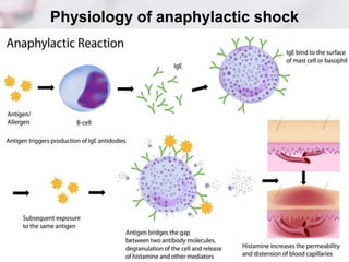 Physiology of anaphylactic shock
 