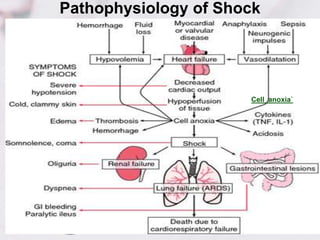 Pathophysiology of Shock
Cell anoxia`
 