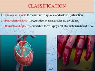 Obstructive Shock Heart Example shock-180613074042-converted.pptx