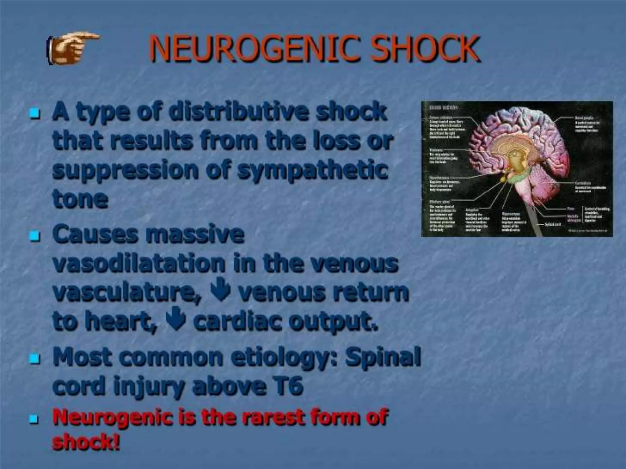 Shock ppt
