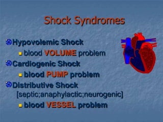 Shock ppt