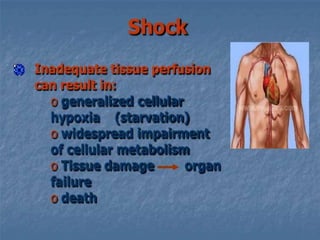 Shock ppt