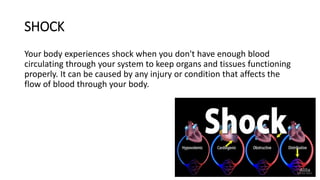 Shock Create Shock -kinds of schock and how to prevent | PPTX