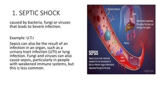 Sepsis Shock Example Shock -kinds of schock and how to prevent | PPTX