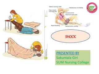 SHOCK
PRESENTED BY
Sakuntala Giri
SUM Nursing College
 