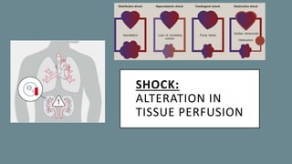 SHOCK:
ALTERATION IN
TISSUE PERFUSION
 