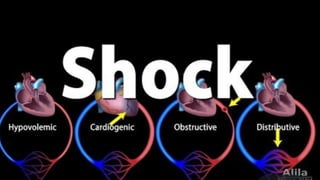 Shock ppt for medical student | PPT