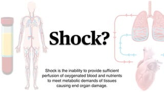 Shock?
Shock is the inability to provide suf
fi
cient
perfusion of oxygenated blood and nutrients
to meet metabolic demands of tissues
causing end organ damage.
 