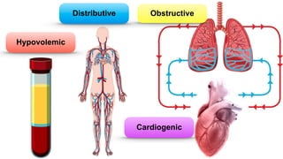 Distributive
Hypovolemic
Obstructive
Cardiogenic
 