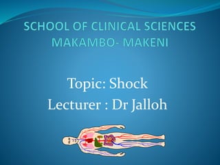 Topic: Shock
Lecturer : Dr Jalloh
 