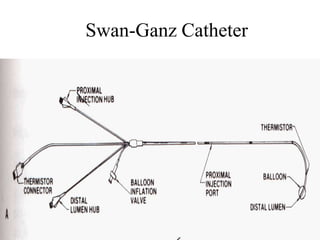 Swan-Ganz Catheter
 