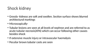 Shock kidney
• Grossly- kidneys are soft and swollen. Section surface shows blurred
architectural markings
• Microscopically-
• Tubular lesions are seen at all levels of nephron and are referred to as
acute tubular necrosis(ATN) which can occur following other causes
besides shock
• If extensive muscle injury or intravascular haemolysis
• Peculiar brown tubular casts are seen
 