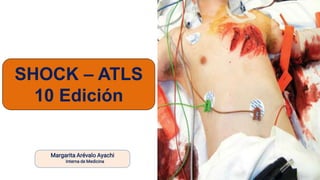 Margarita Arévalo Ayachi
Interna de Medicina
SHOCK – ATLS
10 Edición
 