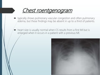 Chest roentgenogram
 typically shows pulmonary vascular congestion and often pulmonary
edema, but these findings may be absent in up to a third of patients.
 heart size is usually normal when CS results from a first MI but is
enlarged when it occurs in a patient with a previous MI.
 