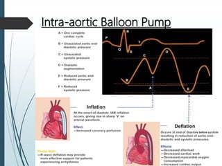 Intra-aortic Balloon Pump
 