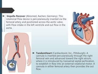  Impella Recover (Abiomed, Aachen, Germany). This
rotational Flow device is percutaneously inserted via the
femoral artery and positioned across the aortic valve,
with Flow intake in the left ventricle and out flow in the
aorta.
 TandemHeart (CardiacAssist, Inc., Pittsburgh). A
cannula is inserted percutaneously through the right
femoral vein and advanced toward the right atrium,
where it is introduced by transatrial septal perforation,
to establish in flow into an external rotational motor. A
cannula in either femoral artery then provides the out
flow.
 
