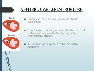 VENTRICULAR SEPTAL RUPTURE
 Clinical features: Chest pain, shortness of breath,
hypotension
 Echo-Doppler - shunting of blood from the Lt to the Rt
ventricle and may visualize the opening in the
interventricular septum.
 IABP support and surgical correction for suitable
candidates.
 