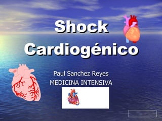 Shock Cardiogénico Paul Sanchez Reyes MEDICINA INTENSIVA 